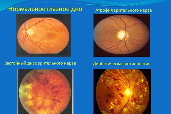 Аккаунты кракен
