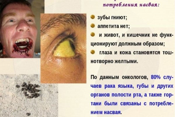 Кракен шеринг